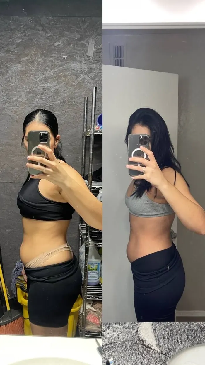 Antes y después — resultado real
