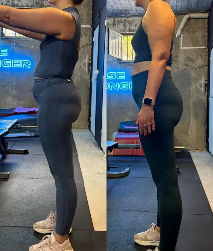 Antes y después — resultado real