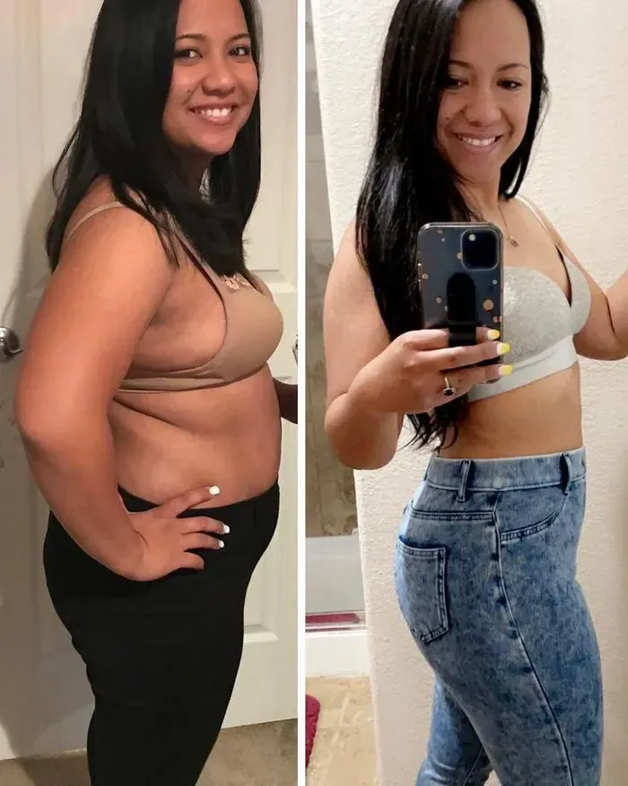 Antes y después — resultado real
