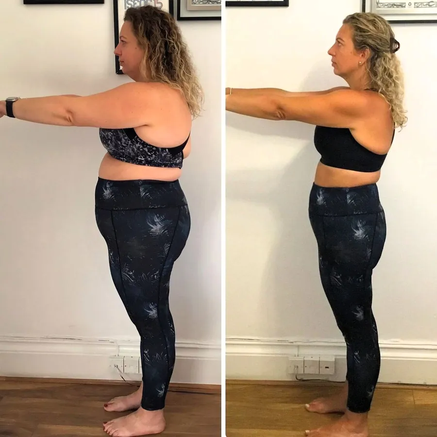 Antes y después — resultado real 21 días